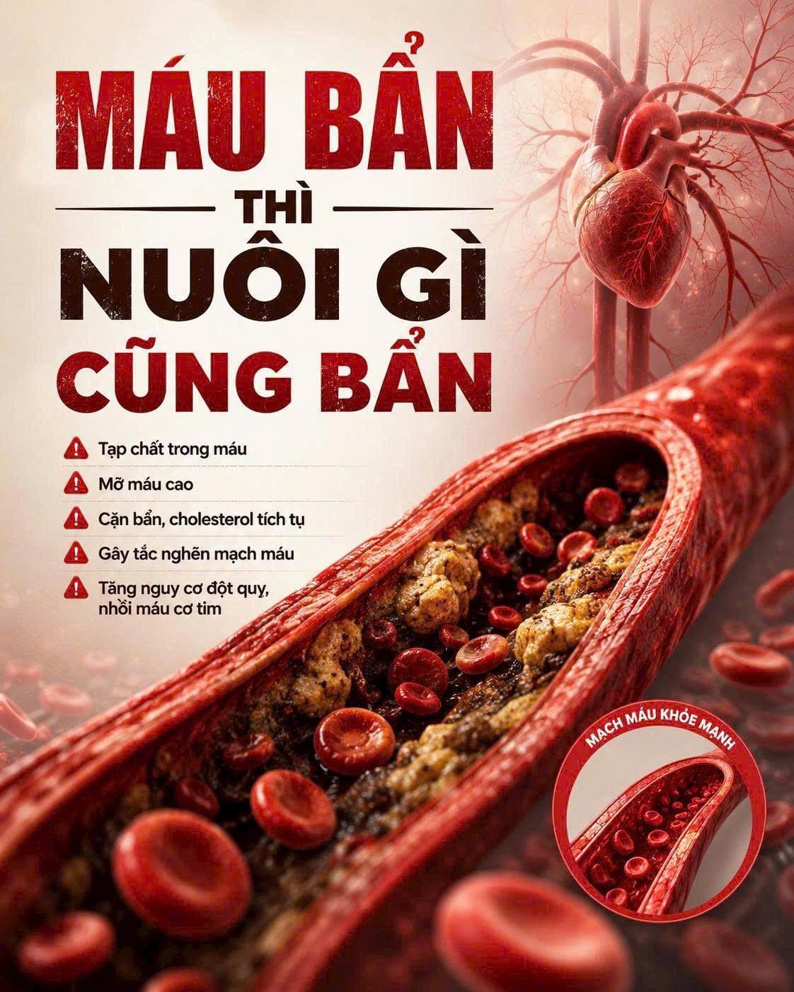 Educational artwork about blood lipids and vascular health
